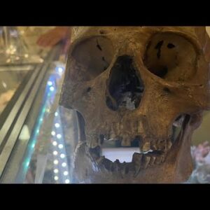 Human Skull Discovered for Sale in Antiques Market