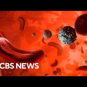 Hundreds with sickle cell disease denied benefits