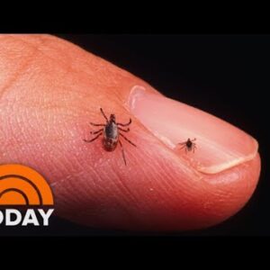 New Lyme Disease Vaccine Enters Final Segment: What To Know